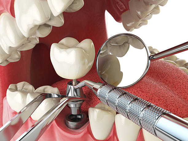 Best Emergency Treatment for Dental Infections or Abscesses in Sand Hill, PA